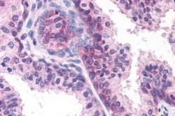 DHRS7 Antibody, Novus Biologicals 50 &mu;g | Buy Online | Novus Biologicals | Fisher Scientific