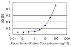 DHRS9 Antibody (3E3), Novus Biologicals 0.1 mg | Buy Online | Novus Biologicals | Fisher Scientific