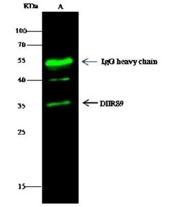 DHRS9 Antibody, Novus Biologicals 50 &mu;g, Unconjugated:Antibodies, Polyclonal