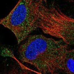 DHRSX Rabbit anti-Human, Polyclonal, Novus Biologicals 100 &mu;g; Unconjugated:Antibodies,