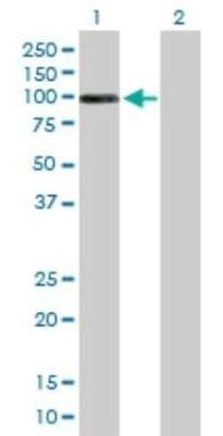 DHTKD1 Antibody, Novus Biologicals 0.05 mg, Unconjugated:Antibodies, Polyclonal
