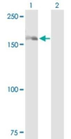 DHX29 Antibody, Novus Biologicals 0.05 mg | Buy Online | Novus Biologicals | Fisher Scientific
