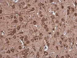 DHX36 Antibody, Novus Biologicals 100 &mu;g | Buy Online | Novus Biologicals | Fisher Scientific