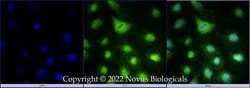 DHX37 Antibody, Novus Biologicals:Antibodies:Primary Antibodies