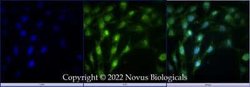 DHX37 Antibody, Novus Biologicals:Antibodies:Primary Antibodies