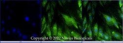 DHX37 Antibody, Novus Biologicals:Antibodies:Primary Antibodies