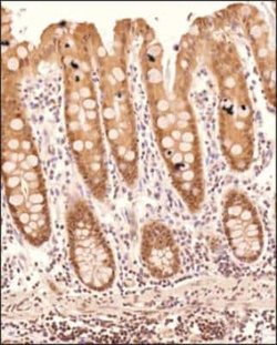 DHX37 Antibody, Novus Biologicals:Antibodies:Primary Antibodies