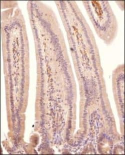 DHX37 Antibody, Novus Biologicals:Antibodies:Primary Antibodies