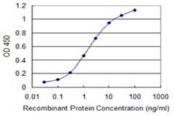 DHX8 Antibody (1D6), Novus Biologicals 0.1 mg | Buy Online | Novus Biologicals | Fisher Scientific