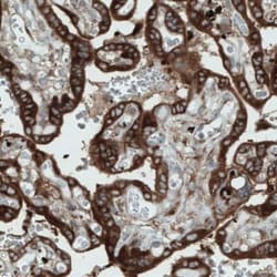 DIAPH-2 Antibody (CL1111), Novus Biologicals 25 &mu;L, Unconjugated:Antibodies,