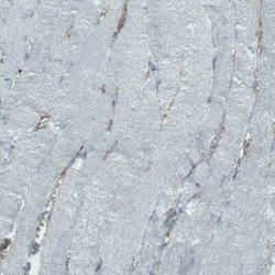 DIAPH-2 Antibody (CL1111), Novus Biologicals 25 &mu;L, Unconjugated:Antibodies,