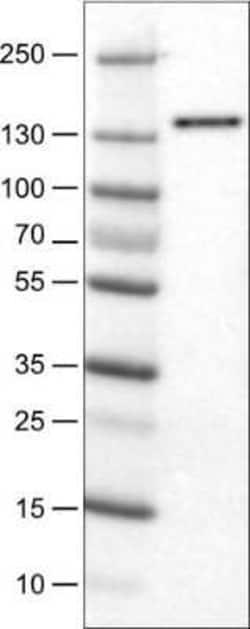 DIAPH-2 Antibody (CL1111), Novus Biologicals:Antibodies:Primary Antibodies