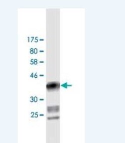 DIAPH1 Antibody (1A8), Novus Biologicals 0.1 mg | Buy Online | Novus Biologicals | Fisher Scientific