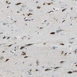 DIAPH1 Antibody, Novus Biologicals 0.1 mL; Unconjugated:Antibodies, Polyclonal