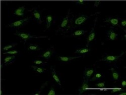 DIDO1 Antibody (3B1), Novus Biologicals 0.1 mg; Unconjugated:Antibodies,