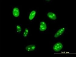 DIMT1L Antibody, Novus Biologicals 0.05 mg | Buy Online | Novus Biologicals | Fisher Scientific