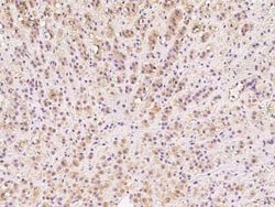 DIMT1L Antibody, Novus Biologicals:Antibodies:Primary Antibodies