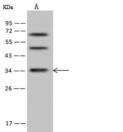 DIMT1L Antibody, Novus Biologicals:Antibodies:Primary Antibodies
