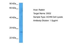 DIO2 Rabbit anti-Human, Rat, Polyclonal, Novus Biologicals 0.1ml; Unconjugated:Antibodies,