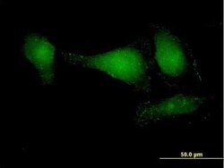 Novus Biologicals DIP13B Antibody, Novus Biologicals 0.05 mg | Buy Online | Novus Biologicals&trade; | Fisher Scientific