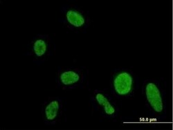 DIP2A Antibody, Novus Biologicals 0.05 mg | Buy Online | Novus Biologicals | Fisher Scientific