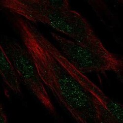 DIRC1 Antibody, Novus Biologicals 25ul; Unconjugated:Antibodies, Polyclonal