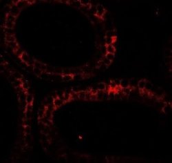 DIS3 Antibody - BSA Free, Novus Biologicals 0.1 mg; Unconjugated:Antibodies,