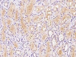 DIS3L Antibody, Novus Biologicals:Antibodies:Primary Antibodies