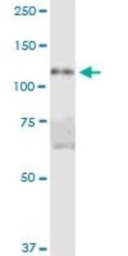 DIS3L Antibody, Novus Biologicals 0.05 mg | Buy Online | Novus Biologicals | Fisher Scientific