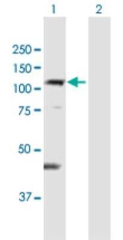 DIS3L Antibody, Novus Biologicals 0.05 mg | Buy Online | Novus Biologicals | Fisher Scientific
