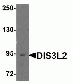 DIS3L2 Antibody - BSA Free, Novus Biologicals 0.1 mg | Buy Online | Novus Biologicals | Fisher Scientific