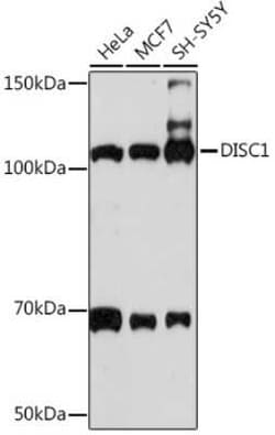 DISC1 Rabbit anti-Human, Mouse, Rat, Clone: 4U5N1, Novus Biologicals 100 &mu;g | Buy Online | Novus Biologicals | Fisher Scientific