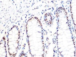 DKC1 Rabbit anti-Human, Mouse, Rat, Clone: 2W2V6, Novus Biologicals:Antibodies:Primary