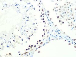 DKC1 Rabbit anti-Human, Mouse, Rat, Clone: 2W2V6, Novus Biologicals:Antibodies:Primary