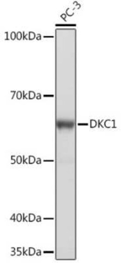 DKC1 Rabbit anti-Human, Mouse, Rat, Clone: 2W2V6, Novus Biologicals:Antibodies:Primary