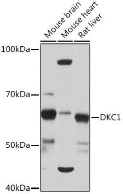 DKC1 Rabbit anti-Human, Mouse, Rat, Clone: 2W2V6, Novus Biologicals:Antibodies:Primary