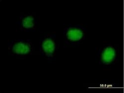 DKFZP434B168 Antibody, Novus Biologicals 50 &mu;g | Buy Online | Novus Biologicals | Fisher Scientific