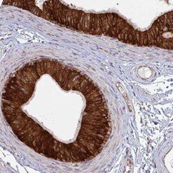 LYSMD4 Antibody, Novus Biologicals:Antibodies:Primary Antibodies