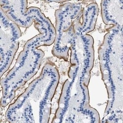 DLC1 Antibody, Novus Biologicals:Antibodies:Primary Antibodies