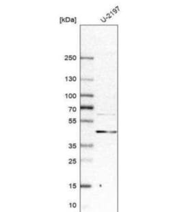 DLC1 Antibody, Novus Biologicals:Antibodies:Primary Antibodies