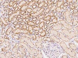 DLC1/DLEC1 Antibody, Novus Biologicals 100 &mu;g | Buy Online | Novus Biologicals | Fisher Scientific