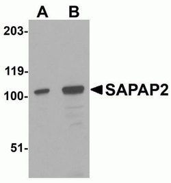 DLGAP2 Antibody - BSA Free, Novus Biologicals 0.1 mg | Buy Online | Novus Biologicals | Fisher Scientific