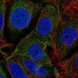 DLGAP3 Rabbit anti-Human, Polyclonal, Novus Biologicals 25 &mu;g | Buy Online | Novus Biologicals | Fisher Scientific