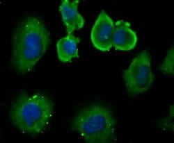 DLL4 Rabbit anti-Human, Rat, Polyclonal, Novus Biologicals 100 &mu;g; Unconjugated:Antibodies,