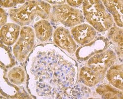 DLL4 Rabbit anti-Human, Rat, Polyclonal, Novus Biologicals 100 &mu;g; Unconjugated:Antibodies,