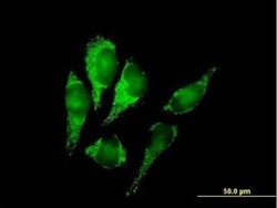 Novus Biologicals DLST Antibody, Novus Biologicals 0.05 mg | Buy Online | Novus Biologicals&trade; | Fisher Scientific