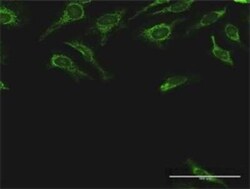 DLST Antibody, Novus Biologicals 0.1 mg | Buy Online | Novus Biologicals | Fisher Scientific