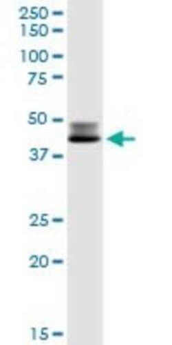DLST Antibody, Novus Biologicals 0.1 mg | Buy Online | Novus Biologicals | Fisher Scientific
