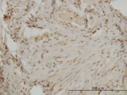 DLX2 Antibody (2B12), Novus Biologicals 0.1 mg | Buy Online | Novus Biologicals | Fisher Scientific