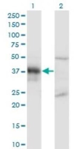 DLX3 Antibody (3B8), Novus Biologicals 0.1 mg | Buy Online | Novus Biologicals | Fisher Scientific